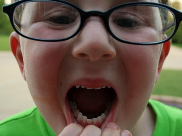 Cum putem preveni cariile dentare la cei mici?
