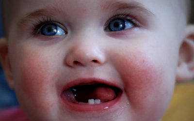 Erupția dentară și dinții de lapte