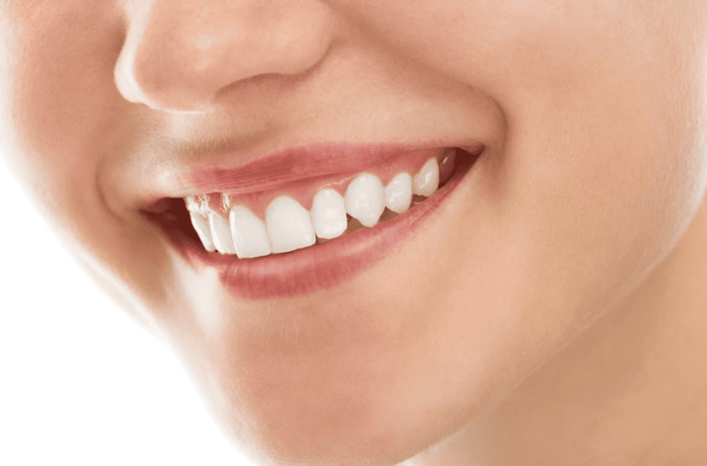 Coroanele dentare: ce sunt și ce avantaje oferă?