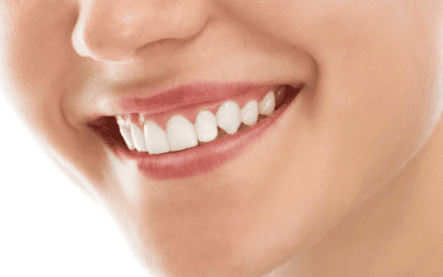 Coroanele dentare: ce sunt și ce avantaje oferă?