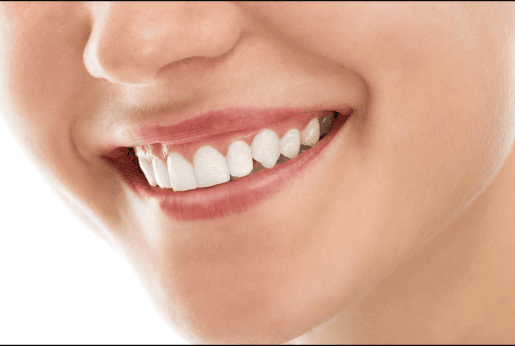 Coroanele dentare: ce sunt și ce avantaje oferă?
