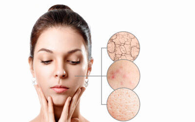 Care sunt cele mai frecvente boli de piele întâlnite și de la ce vârstă pot apărea