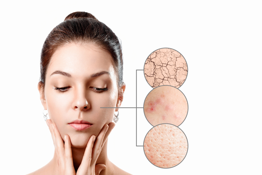 Care sunt cele mai frecvente boli de piele întâlnite și de la ce vârstă pot apărea